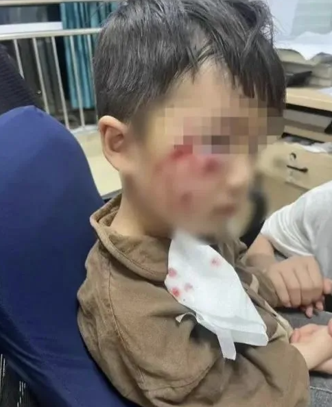 被疯犬咬伤没有“救命药”，怎么办？